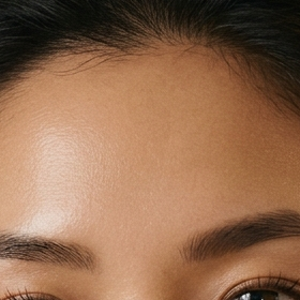 Forehead Lines